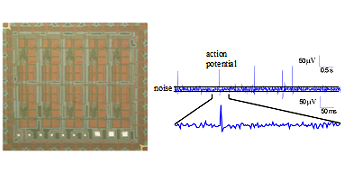 Bioamplifier